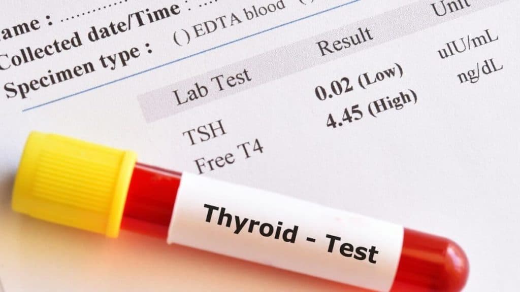 Thyroid tests for healthy thyroid. 