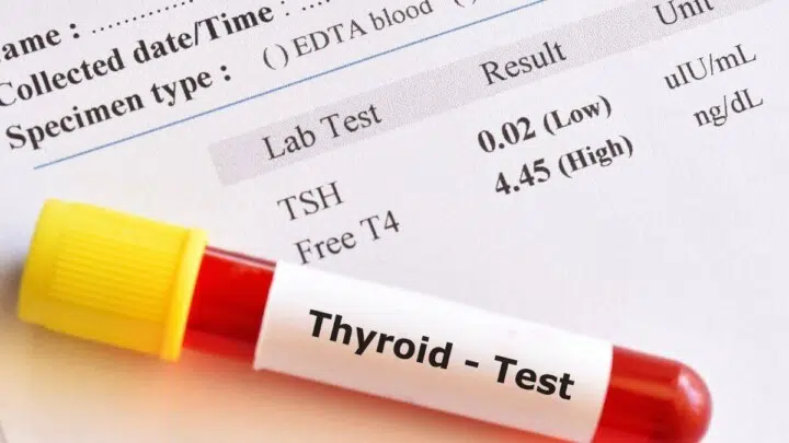 thyroid test