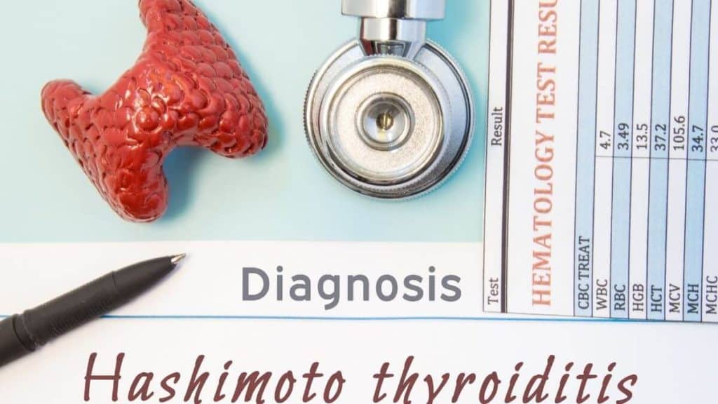 Hashimoto thyroiditis disease can benefit from diet to help also with hypothyroidism. Health food for thyroid can help diagnosis.
