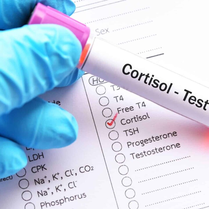 cortisol and weight gain link connection