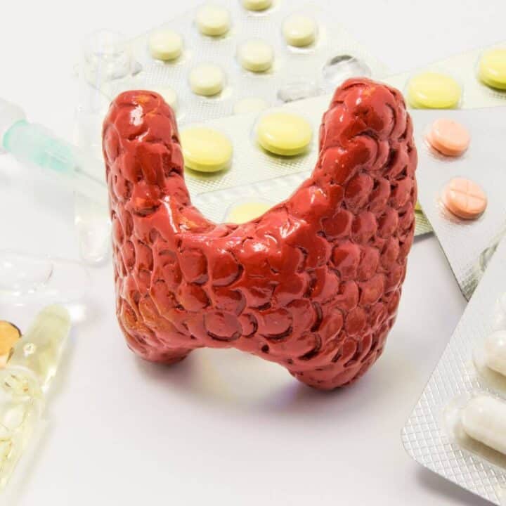 What Causes Hypothyroidism and Can a Pro Thyroid Diet Help?
